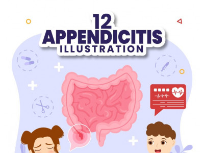 12 Appendicitis Inflammation Illustration